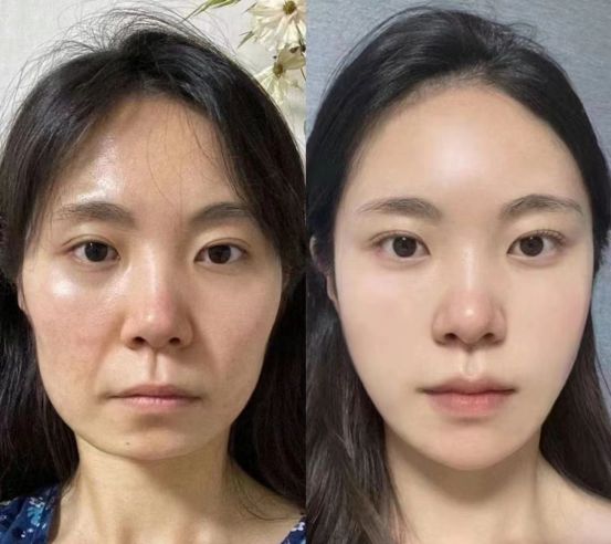 ？岁月不留痕抗皱保养让你青春永驻AG真人平台抗皱紧致护肤品哪款好(图5)